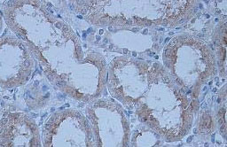 Immunohistochemistry (Formalin/PFA-fixed paraffin-embedded sections) - Anti-ATRAP antibody (AB85175), expandable thumbnail