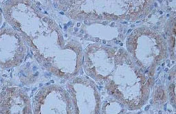 Immunohistochemistry (Formalin/PFA-fixed paraffin-embedded sections) - Anti-ATRAP antibody (AB85175)