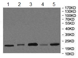 Western blot - Anti-ATRAP antibody (AB85175), expandable thumbnail