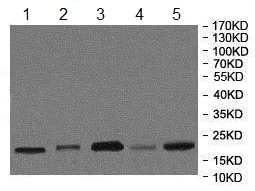 Western blot - Anti-ATRAP antibody (AB85175)