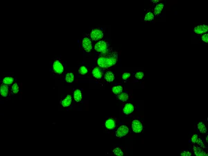 Immunocytochemistry/ Immunofluorescence - Anti-ATRIP antibody [EPR8072(2)] - BSA and Azide free (AB249872)