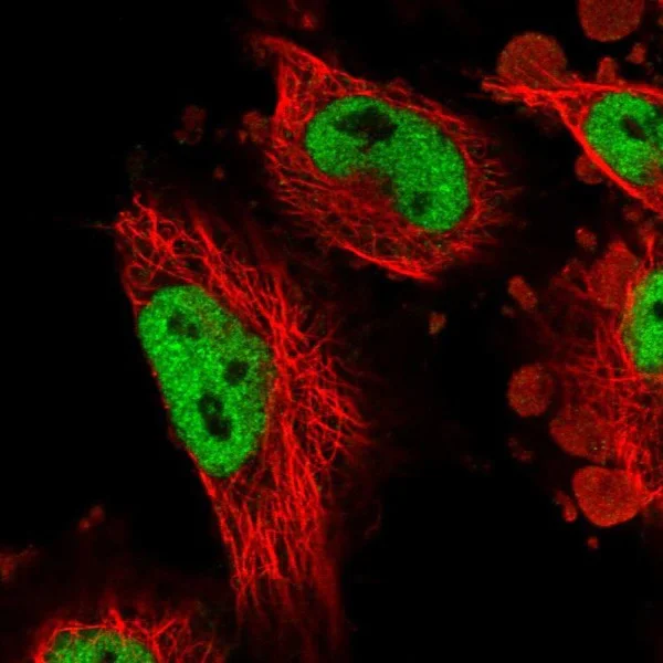 Immunocytochemistry/ Immunofluorescence - Anti-Atrophin 1 antibody (AB224142)