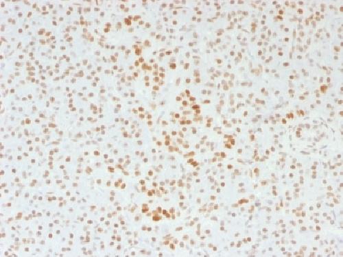 Immunohistochemistry (Formalin/PFA-fixed paraffin-embedded sections) - Anti-ATRX antibody [39f] - BSA and Azide free (AB218936)