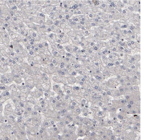 Immunohistochemistry (Formalin/PFA-fixed paraffin-embedded sections) - Anti-ATRX antibody (AB204169)