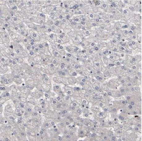 Immunohistochemistry (Formalin/PFA-fixed paraffin-embedded sections) - Anti-ATRX antibody (AB204169)