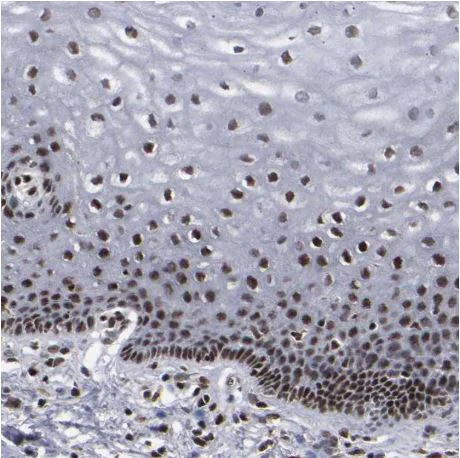 Immunohistochemistry (Formalin/PFA-fixed paraffin-embedded sections) - Anti-ATRX antibody (AB204169)