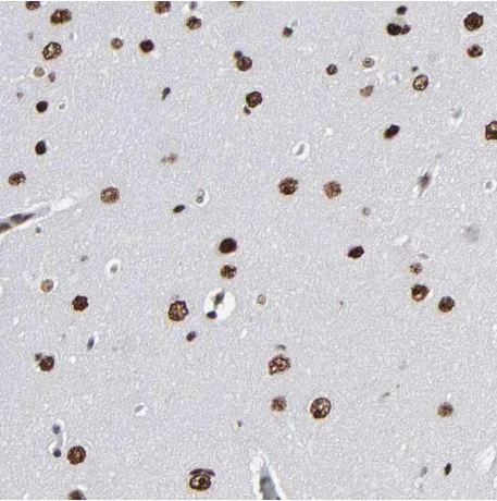 Immunohistochemistry (Formalin/PFA-fixed paraffin-embedded sections) - Anti-ATRX antibody (AB204169)