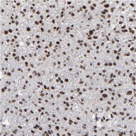 Immunohistochemistry (Formalin/PFA-fixed paraffin-embedded sections) - Anti-ATRX antibody (AB204169)