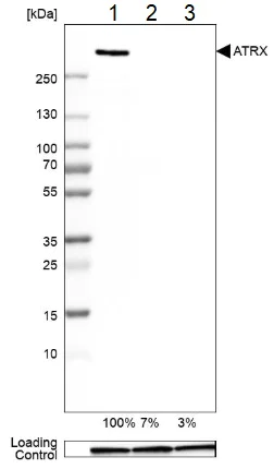Western blot - Anti-ATRX antibody (AB204169)