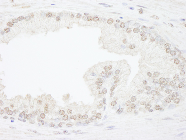 Immunohistochemistry (Formalin/PFA-fixed paraffin-embedded sections) - Anti-ATRX antibody (AB72124)