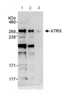 Western blot - Anti-ATRX antibody (AB72124)