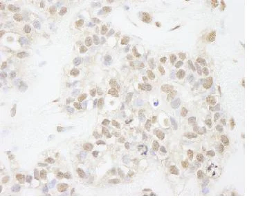 Immunohistochemistry (Formalin/PFA-fixed paraffin-embedded sections) - Anti-ATRX antibody (AB84462)