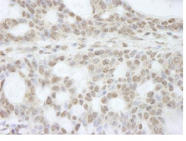 Immunohistochemistry (Formalin/PFA-fixed paraffin-embedded sections) - Anti-ATRX antibody (AB84462)