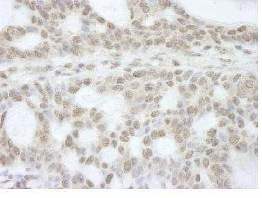 Immunohistochemistry (Formalin/PFA-fixed paraffin-embedded sections) - Anti-ATRX antibody (AB84462)