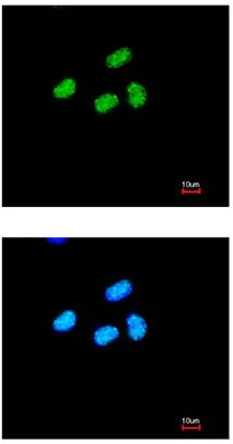 Immunocytochemistry/ Immunofluorescence - Anti-ATRX antibody (AB97508)