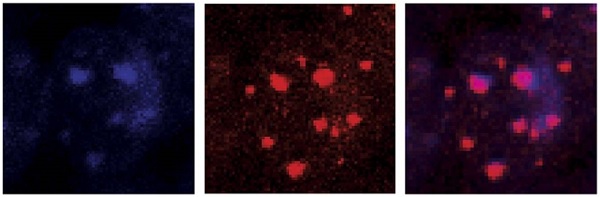 Immunocytochemistry/ Immunofluorescence - Anti-ATRX antibody (AB97508), expandable thumbnail