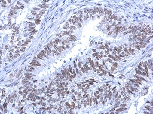 Immunohistochemistry (Formalin/PFA-fixed paraffin-embedded sections) - Anti-ATRX antibody (AB97508), expandable thumbnail