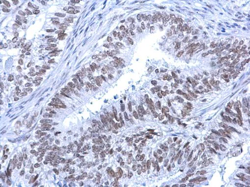 Immunohistochemistry (Formalin/PFA-fixed paraffin-embedded sections) - Anti-ATRX antibody (AB97508)
