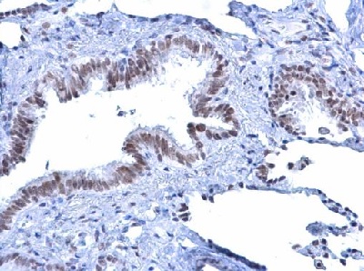 Immunohistochemistry (Formalin/PFA-fixed paraffin-embedded sections) - Anti-ATRX antibody (ab97508), expandable thumbnail