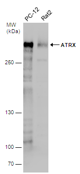 Western blot - Anti-ATRX antibody (AB97508), expandable thumbnail
