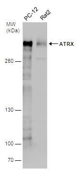 Western blot - Anti-ATRX antibody (AB97508)