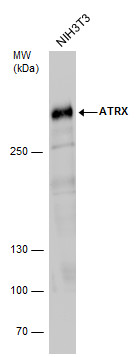 Western blot - Anti-ATRX antibody (ab97508), expandable thumbnail