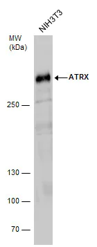 Western blot - Anti-ATRX antibody (AB97508)