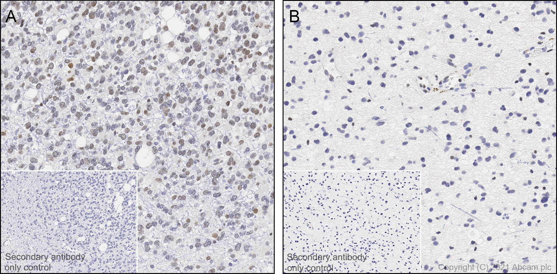 Immunohistochemistry (Formalin/PFA-fixed paraffin-embedded sections) - Anti-ATRX antibody [AMab-6] - BSA and Azide free (AB264544)