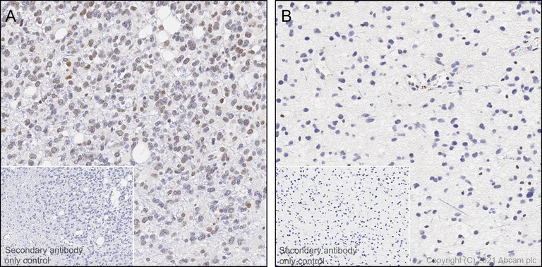 Immunohistochemistry (Formalin/PFA-fixed paraffin-embedded sections) - Anti-ATRX antibody [AMab-6] - BSA and Azide free (AB264544)