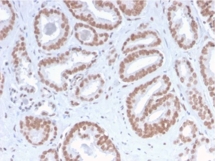 Immunohistochemistry (Formalin/PFA-fixed paraffin-embedded sections) - Anti-ATRX antibody [ATRX/2900R] (AB270272)