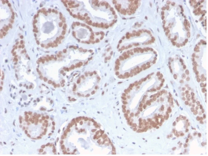 Immunohistochemistry (Formalin/PFA-fixed paraffin-embedded sections) - Anti-ATRX antibody [ATRX/2900R] - BSA and Azide free (AB270303)