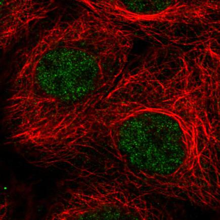 Immunocytochemistry - Anti-ATRX antibody [CL0537] (AB188027), expandable thumbnail