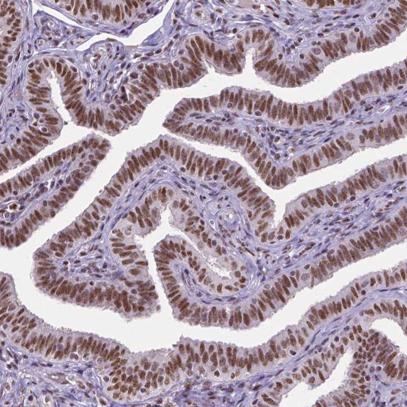 Immunohistochemistry (Formalin/PFA-fixed paraffin-embedded sections) - Anti-ATRX antibody [CL0537] (ab188027), expandable thumbnail