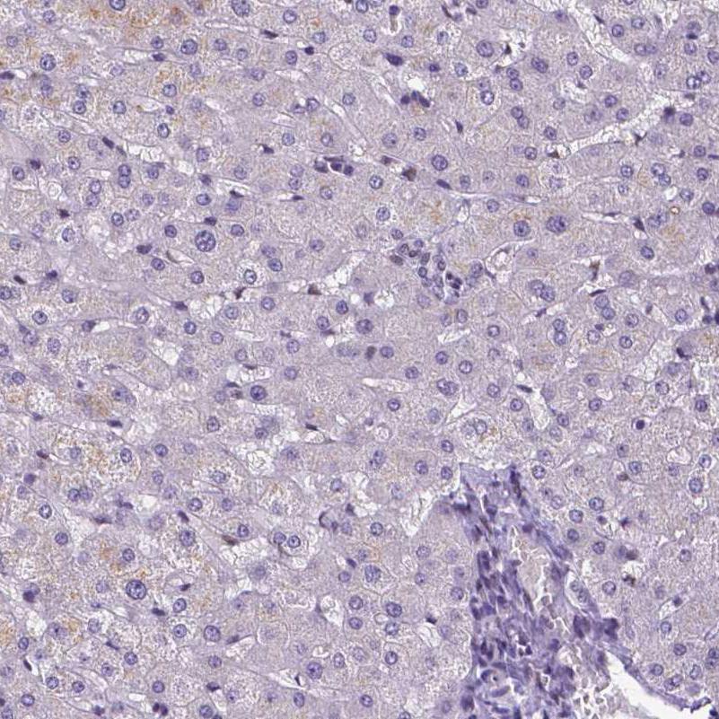 Immunohistochemistry (Formalin/PFA-fixed paraffin-embedded sections) - Anti-ATRX antibody [CL0537] (ab188027), expandable thumbnail