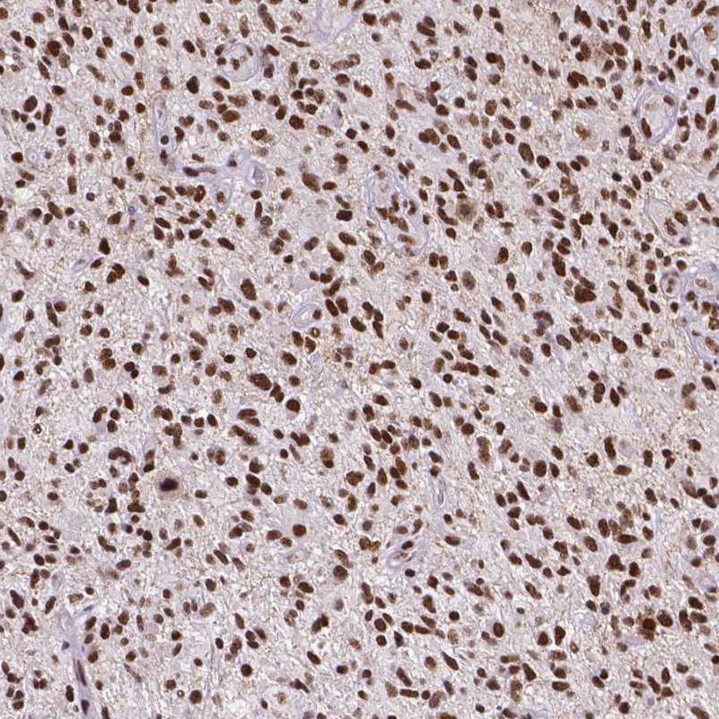Immunohistochemistry (Formalin/PFA-fixed paraffin-embedded sections) - Anti-ATRX antibody [CL0537] (AB188027), expandable thumbnail