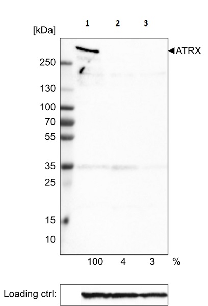 Western blot - Anti-ATRX antibody [CL0537] (AB188027), expandable thumbnail