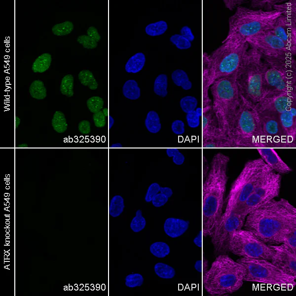 Immunocytochemistry/ Immunofluorescence - Anti-ATRX antibody [EPR29209-280] (AB325390)