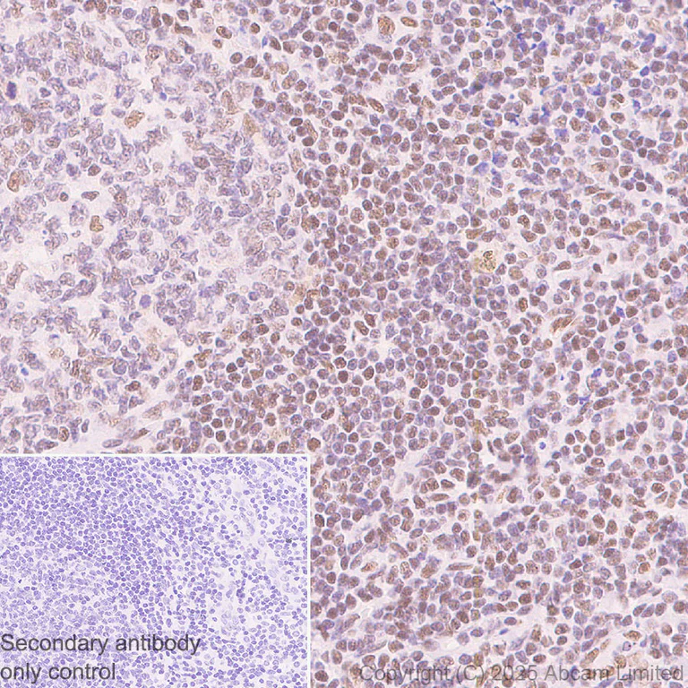 Immunohistochemistry (Formalin/PFA-fixed paraffin-embedded sections) - Anti-ATRX antibody [EPR29209-280] (AB325390)