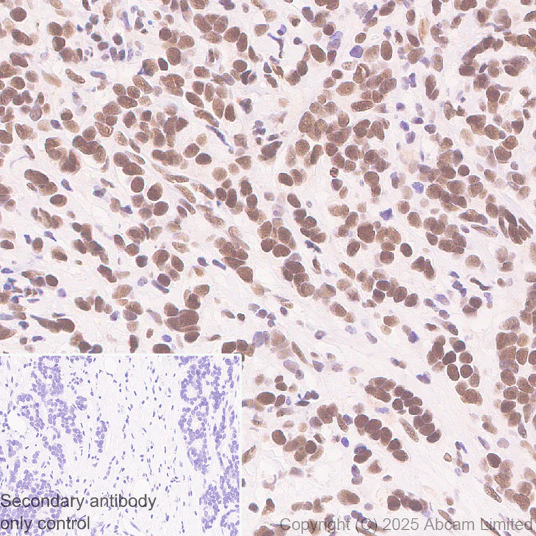 Immunohistochemistry (Formalin/PFA-fixed paraffin-embedded sections) - Anti-ATRX antibody [EPR29209-280] (AB325390)