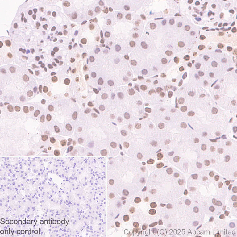 Immunohistochemistry (Formalin/PFA-fixed paraffin-embedded sections) - Anti-ATRX antibody [EPR29209-280] (AB325390)