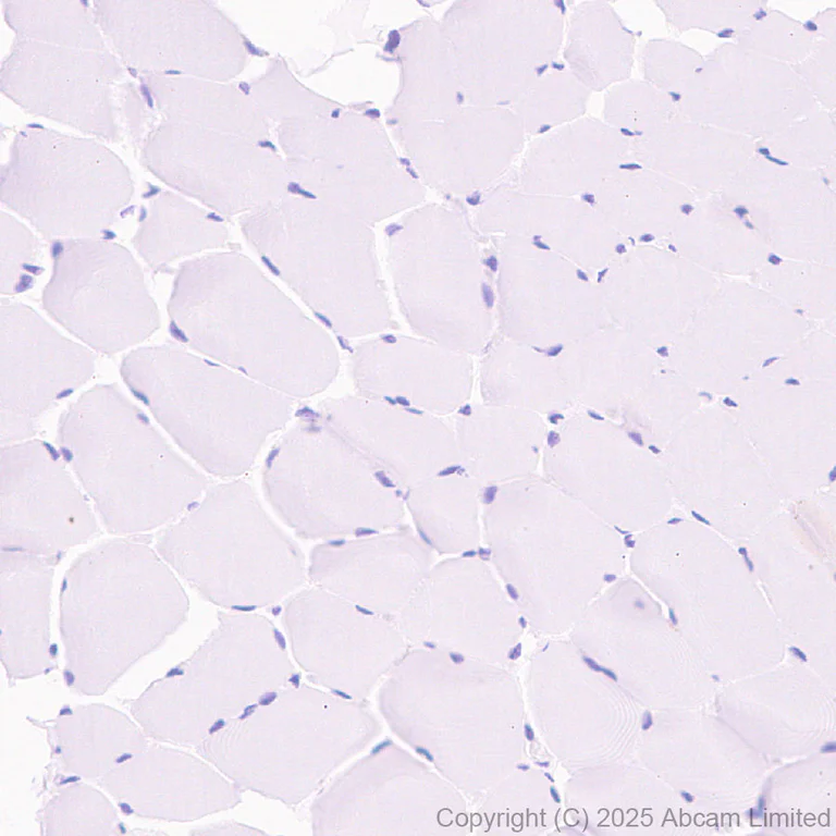 Immunohistochemistry (Formalin/PFA-fixed paraffin-embedded sections) - Anti-ATRX antibody [EPR29209-280] (AB325390)