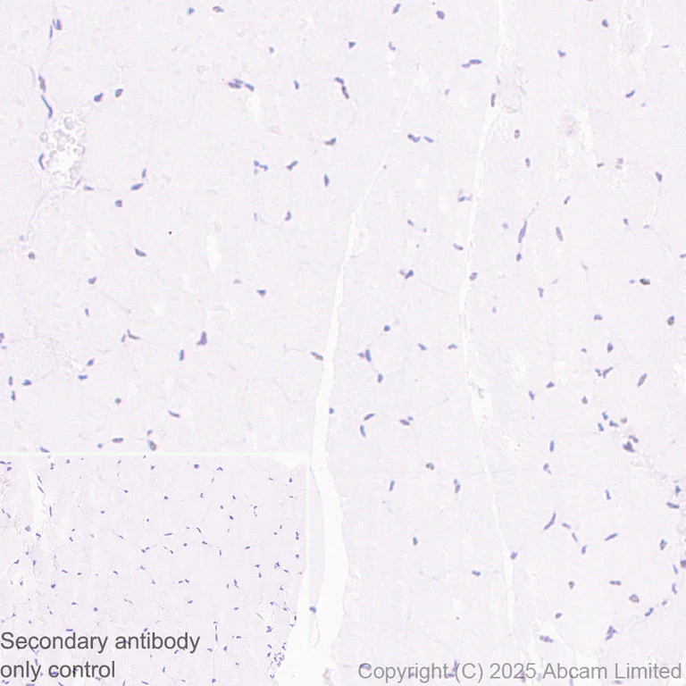 Immunohistochemistry (Formalin/PFA-fixed paraffin-embedded sections) - Anti-ATRX antibody [EPR29209-280] (AB325390)