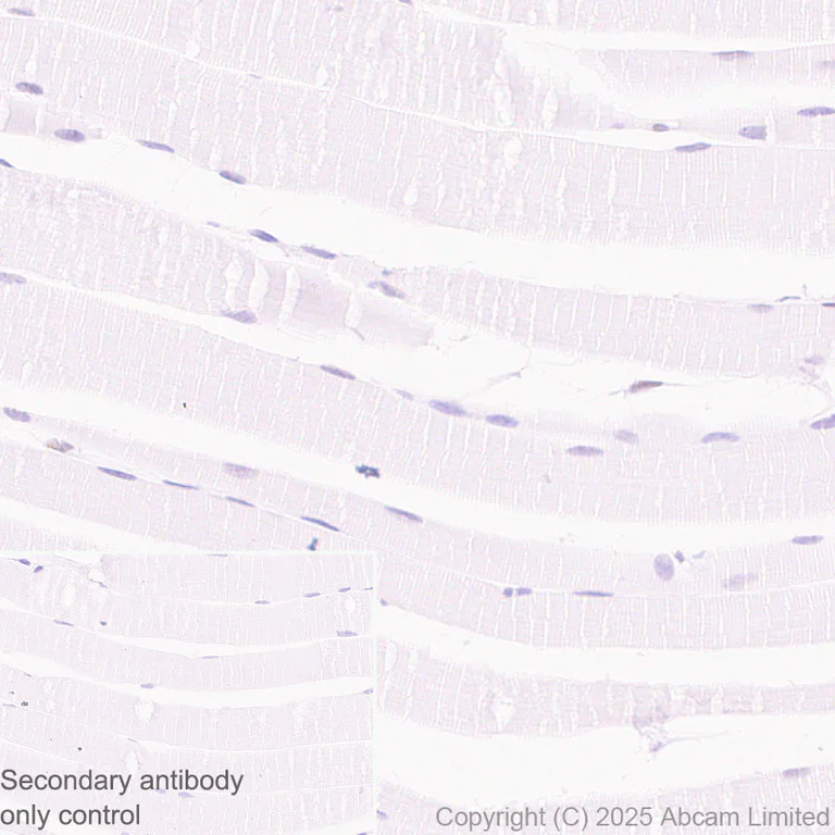 Immunohistochemistry (Formalin/PFA-fixed paraffin-embedded sections) - Anti-ATRX antibody [EPR29209-280] (AB325390)