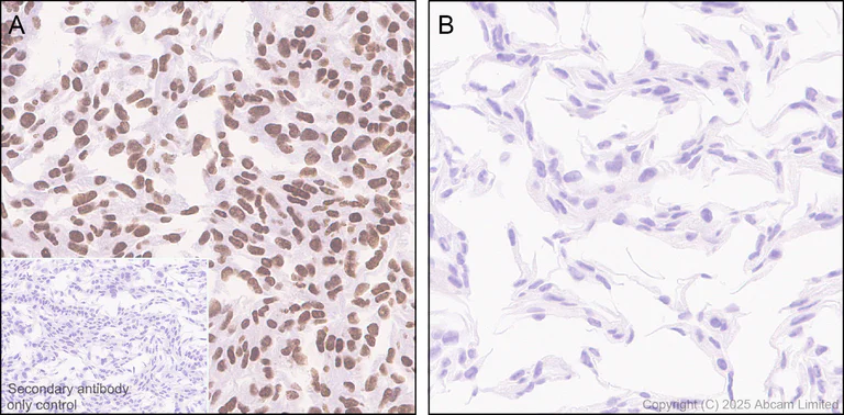 Immunohistochemistry (Formalin/PFA-fixed paraffin-embedded sections) - Anti-ATRX antibody [EPR29209-280] (AB325390)