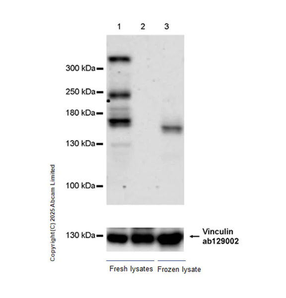 Western blot - Anti-ATRX antibody [EPR29209-280] (AB325390)