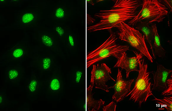 Immunocytochemistry/ Immunofluorescence - Anti-ATRX antibody [HL1210] (AB307808)