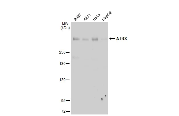 Western blot - Anti-ATRX antibody [HL1210] (AB307808)
