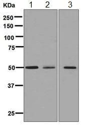 Western blot - Anti-ATTY antibody [EPR6121] (AB125000)