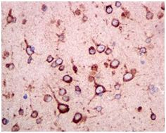 Immunohistochemistry (Formalin/PFA-fixed paraffin-embedded sections) - Anti-ATTY antibody [EPR6121] - BSA and Azide free (AB248092), expandable thumbnail