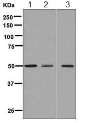Western blot - Anti-ATTY antibody [EPR6121] - BSA and Azide free (AB248092), expandable thumbnail